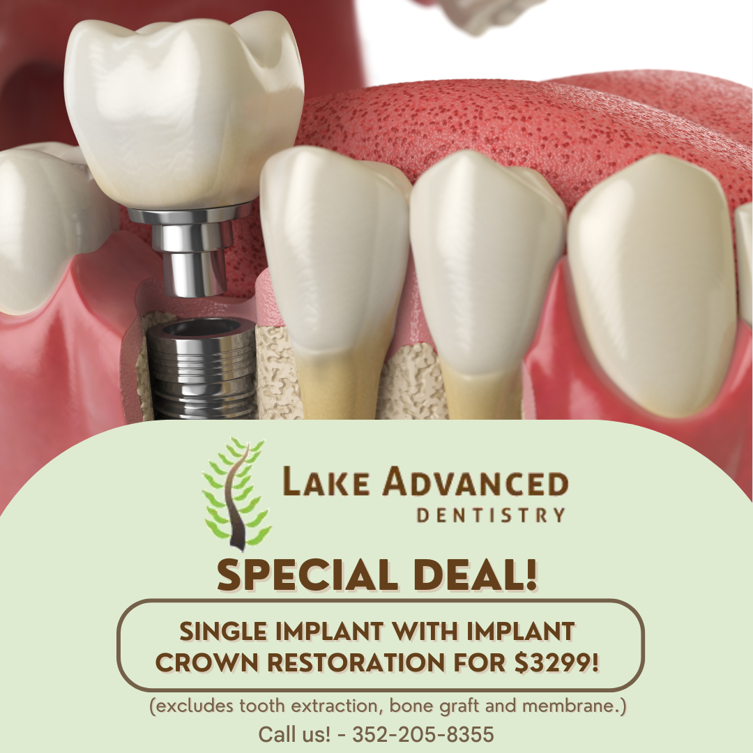 Lake Advanced Dentistry | Dental Sealants, Teeth Whitening and Sedation Dentistry